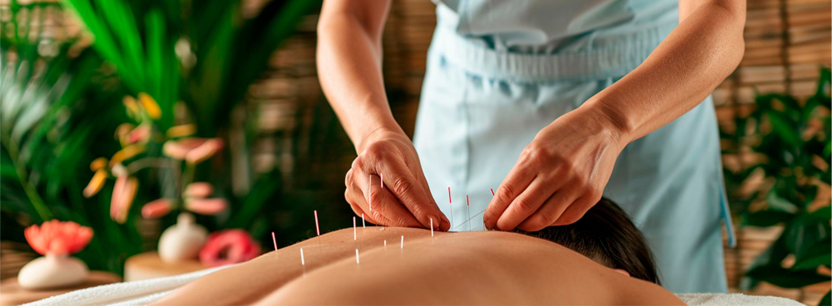 sciatica