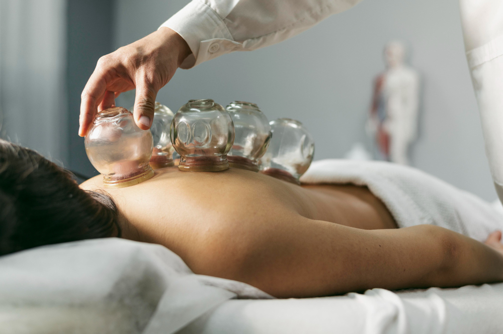 Cupping therepy