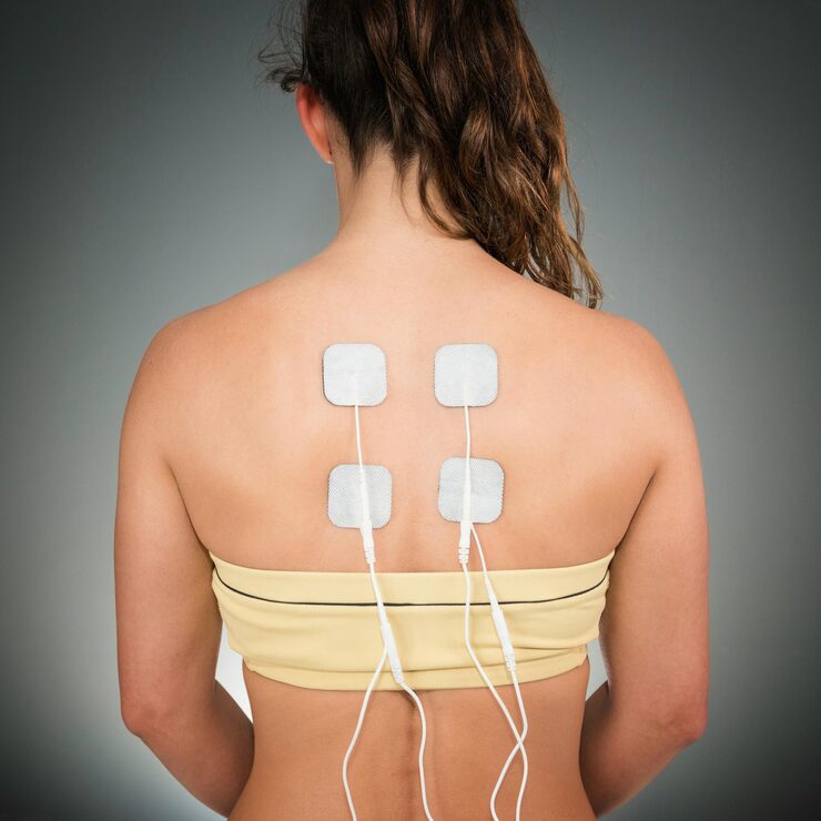 tens-treatment